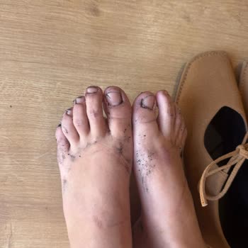 Yeni Alınan Ayakkabının Boyası Ayaklarıma Geçti Ve İç Kısmı Dökülmeye Başladı