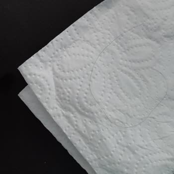 Yoğurttan Çıkan Uzun Kıl Hijyen Endişesi Yarattı