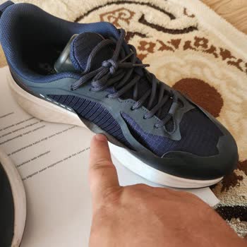 Kısa Sürede Soyulan Ayakkabı İçin İade Talebim Reddedildi