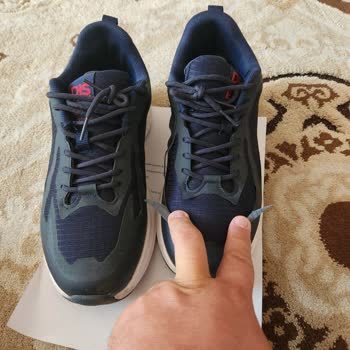 Kısa Sürede Soyulan Ayakkabı İçin İade Talebim Reddedildi