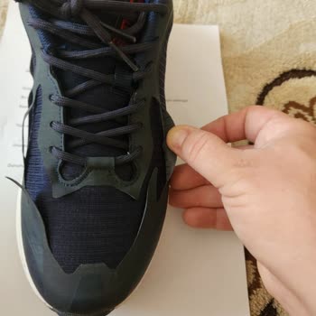 Kısa Sürede Soyulan Ayakkabı İçin İade Talebim Reddedildi