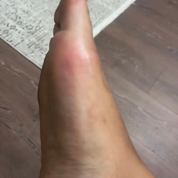 Kısa Sürede Hasar Veren Sandalet İçin İade Talebim Reddedildi