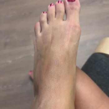 Kısa Sürede Hasar Veren Sandalet İçin İade Talebim Reddedildi