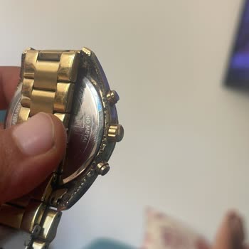 Garanti Kapsamındaki Saatte Renk Değişimi Ve Alerji Sorunu, Çözüm Sunulmuyor