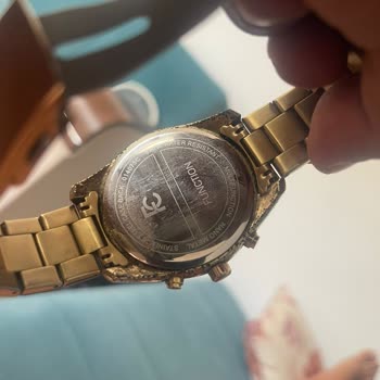 Garanti Kapsamındaki Saatte Renk Değişimi Ve Alerji Sorunu, Çözüm Sunulmuyor