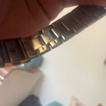 Garanti Kapsamındaki Saatte Renk Değişimi Ve Alerji Sorunu, Çözüm Sunulmuyor