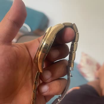 Garanti Kapsamındaki Saatte Renk Değişimi Ve Alerji Sorunu, Çözüm Sunulmuyor