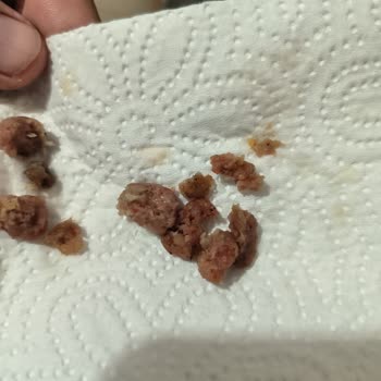 Aldığım Mantı Bozuk Çıktı, Ücret İadesi Talep Ediyorum