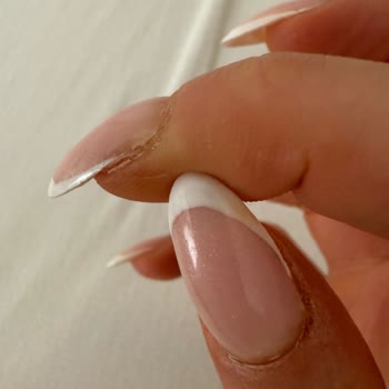 Protez Tırnak İşlemi İki Kez Bozuldu Çözüm Sunulmadı