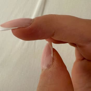 Protez Tırnak İşlemi İki Kez Bozuldu Çözüm Sunulmadı