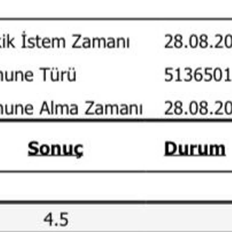 Haksız Ücret Tahsilatı Ve Geri Dönüş Eksikliği