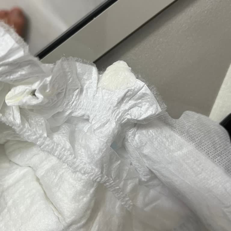 Bebek Bezi Paketinden Yabancı Madde Çıkması Nedeniyle Endişe Ve Mağduriyet