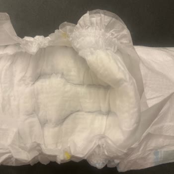 Molfix 3 Numara Bebek Bezinde Yapısal Değişiklik Sonrası Cilt Sorunları Ve Mağduriyet