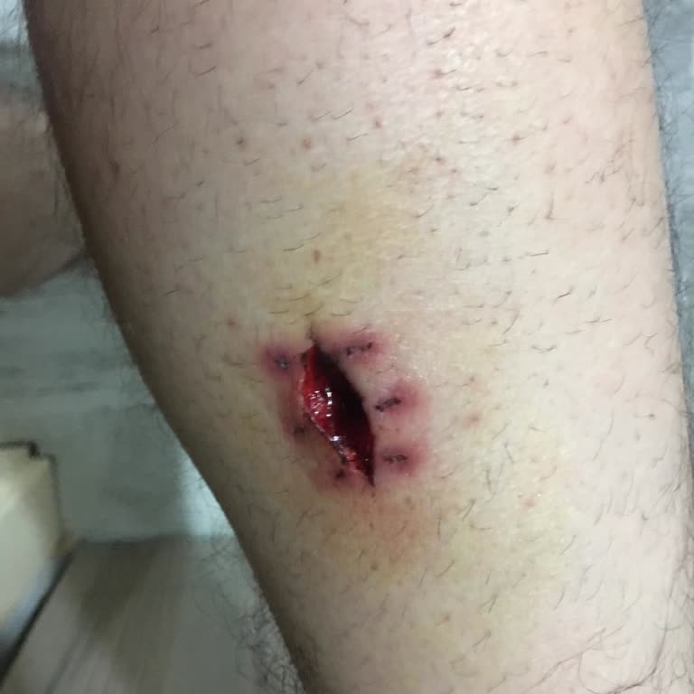 Mamak Devlet Hastanesi Genel Cerrahi Doktorunun İşini Düzgün Yapmaması