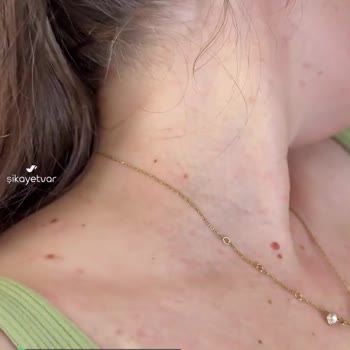 Swarovski Kolye Alerji Yapıyor Ve Orijinalliği Şüpheli