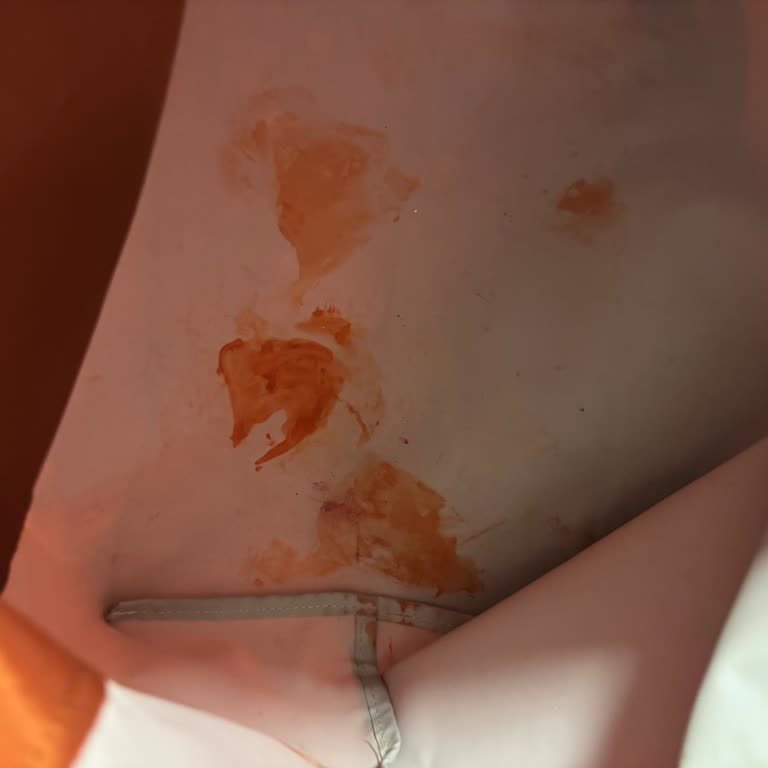 Longchamp Çantamın Rengi İç Astara Geçti, Değişim Veya İade Talebim Reddedildi