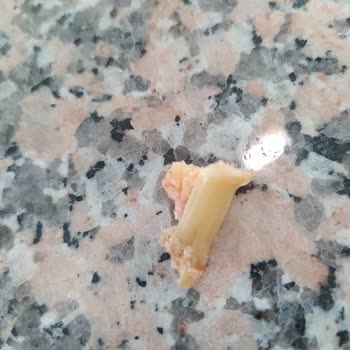 Superfresh Pizzada Sert Yabancı Cisim Ve Tekrar Eden Kalite Sorunu