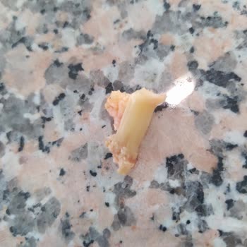 Superfresh Pizzada Sert Yabancı Cisim Ve Tekrar Eden Kalite Sorunu