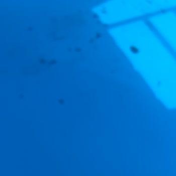 Jolly Tur Otelin Hijyen Sorunları Ve Denizde Sağlık Riski Yaşadık