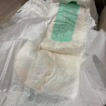 Fresh Life Hijyenik Olmayan Hasta Bezi Mağduriyeti Ve İade Sorunu