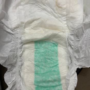 Fresh Life Hijyenik Olmayan Hasta Bezi Mağduriyeti Ve İade Sorunu