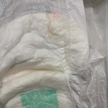 Fresh Life Hijyenik Olmayan Hasta Bezi Mağduriyeti Ve İade Sorunu