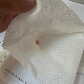 Ton Balıklı Salatada Çiğ Et Parçası Ve Hijyen Sorunu Yaşadım, İade Yapılmadı