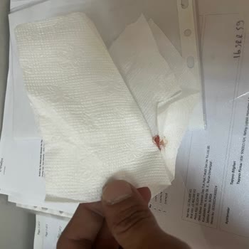 Ton Balıklı Salatada Çiğ Et Parçası Ve Hijyen Sorunu Yaşadım, İade Yapılmadı