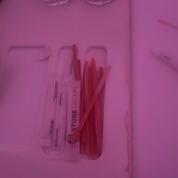 Kirli Oda Ve İlgisiz Otel-jolly Tur Desteğiyle Tatilim Zehir Oldu