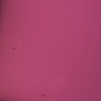 Kirli Oda Ve İlgisiz Otel-jolly Tur Desteğiyle Tatilim Zehir Oldu