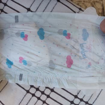 Agu Baby Bebek Bezlerinde Emme Alanı Hatası Ve Taşma Sorunu