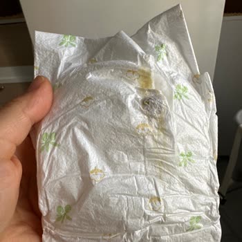 Bebek Bezinde Şüpheli Madde Ve Güven Sorunu