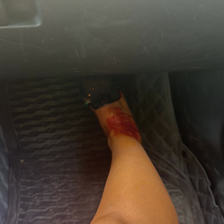 Açık Yaralı Halde Bavul Teslimi Yapılmadı, Ek Ücret Ödedim Mağdur Oldum