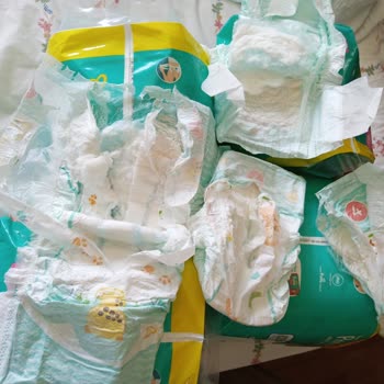 Prima Bebek Bezlerinde Tekrarlayan Kristalleşme Ve İlgisiz Müşteri Hizmeti