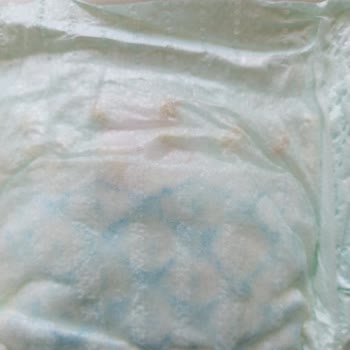 Prima Bebek Bezlerinde Tekrarlayan Kristalleşme Ve İlgisiz Müşteri Hizmeti