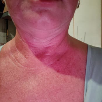 Acil Serviste Hayati Tehlikeye Rağmen Müdahale Edilmedi