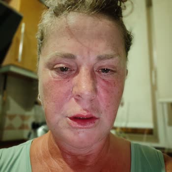 Acil Serviste Hayati Tehlikeye Rağmen Müdahale Edilmedi