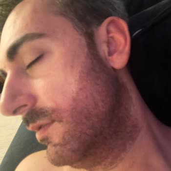 Phyto Color Sachane causó irritación y quemaduras en cabello y barba