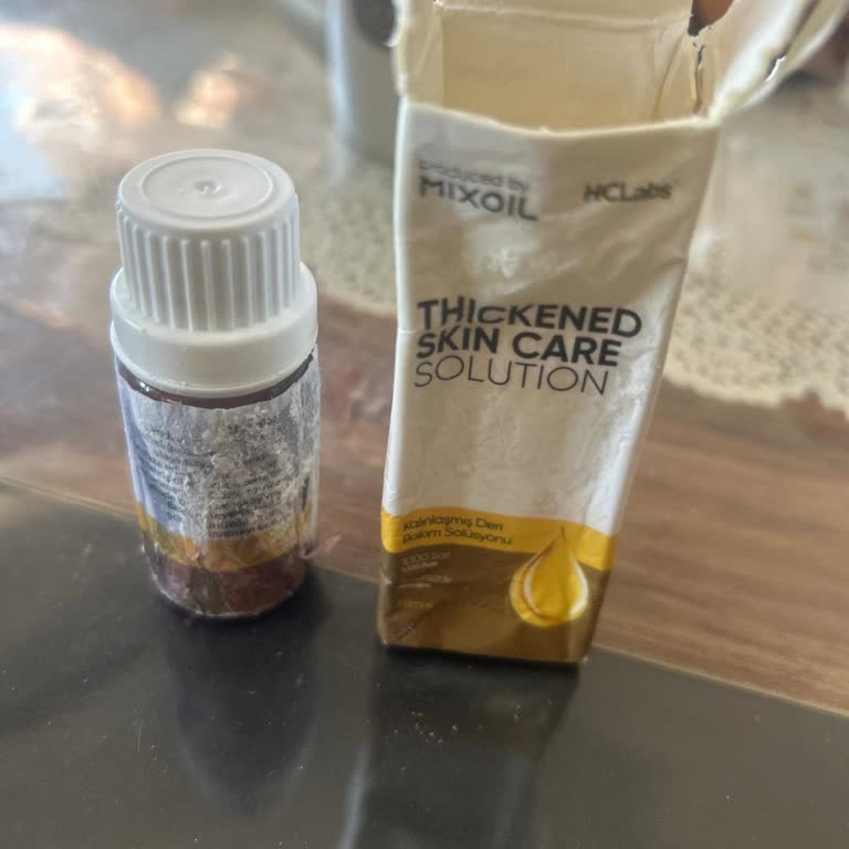 Açılmış Ve Akmış Ürün, Müşteri Hizmetlerine Ulaşılamıyor