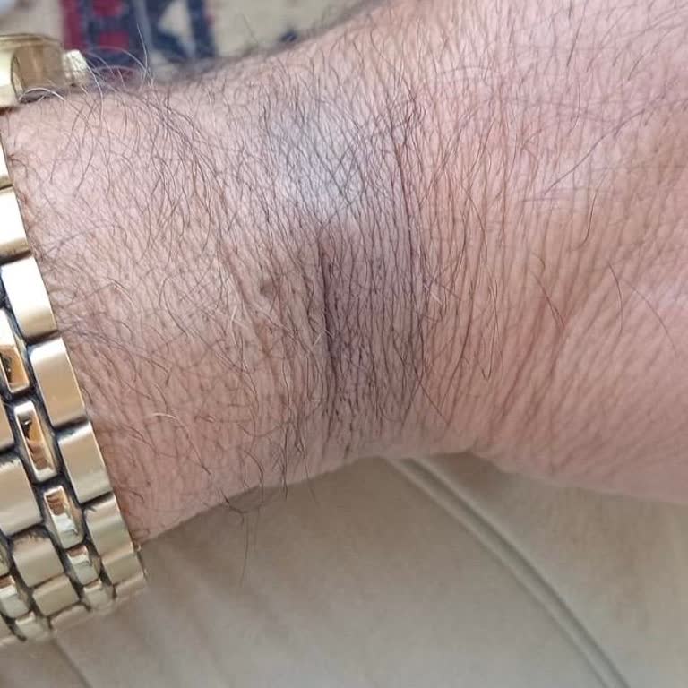 Çelik Saatin Kordonu Leke Bırakıyor, İade Ve Değişim Talebim Reddedildi