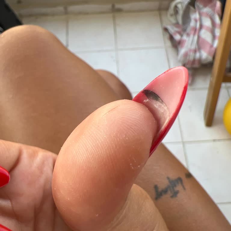 Kötü Hizmet Ve Saygısız Davranış Sonrası Yüksek Ücret