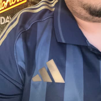 Adidas Fenerbahçe Formasında Tekrar Eden Logo Kararması Mağduriyeti