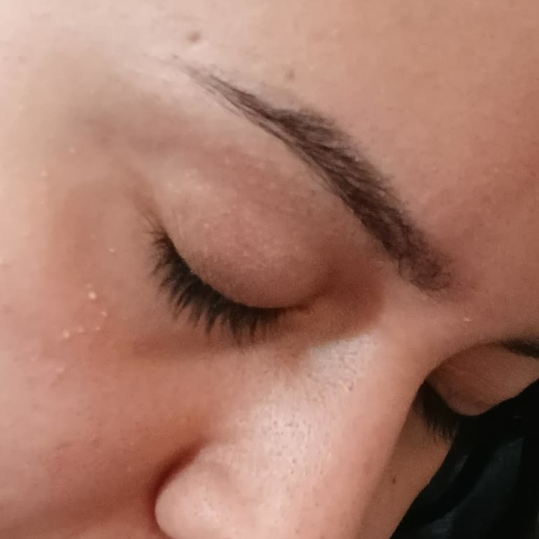 Microblading Sonrası Kaşlarımda Orantısızlık Ve İletişim Engeli