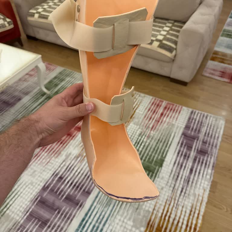 Hacettepe Ortopedi Samsun Mağduriyet Yaşadık