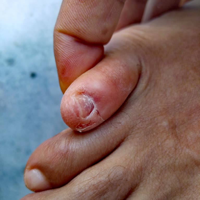 Hayal Kırıklığı Ve Mağduriyetle Sonuçlanan Tatil Deneyimi: Tatilbudur.com Ve Otel Yönetimine Güvenim Sarsıldı