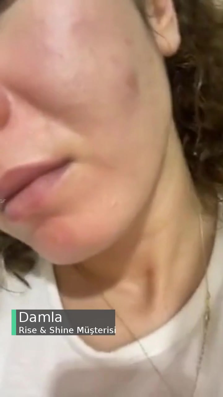 Rise & Shine Kalitesiz Bir Ürün videonun kapak resmi