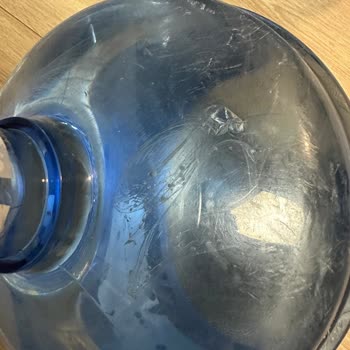 Damacanada Yabancı Maddeyle Karşılaştım Hijyen Konusunda Endişeliyim