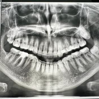 Dentway Diş Hekimliği Maddi ve Manevi Olarak Kaybeden Ben Oluyorum