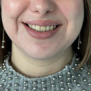 Dentway Diş Hekimliği Maddi ve Manevi Olarak Kaybeden Ben Oluyorum