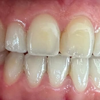 Dentway Diş Hekimliği Maddi ve Manevi Olarak Kaybeden Ben Oluyorum